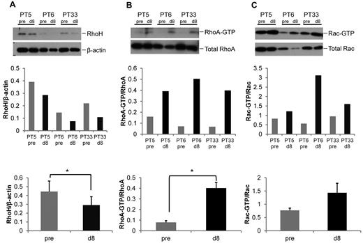 Figure 7. In vivo lenalidomide treatment of primary human CLL cells results in decreased RhoH expression and increased RhoA and Rac activation. CLL patients were treated daily for 8 days with 2.5 mg lenalidomide within a clinical phase 1 study. All samples obtained from 6 patients before (pre) and on day 8 (d8) of lenalidomide treatment contained > 87% CD19+ cells. Representative blots of 3 patients are displayed. (A) Western blot analysis for RhoH protein expression. (B-C) RhoA and Rac activities determined by pull-down assays. In each panel the protein of interest or active (GTP-bound) protein is shown in top panel and the loading control or total protein is shown in the bottom panel. The bar graphs in the middle panel show ratio of RhoH to β-actin and activated GTP-bound RhoA or Rac protein to total RhoA or Rac protein based on densitometric measurements of the respective Western blot band before and after treatment for each of the 3 patients. The bar graphs in the bottom panel summarize the ratios obtained in all 6 patients (gray bars: pre treatment vs black bars: day 8 results; mean ± SEM, *P < .05, Student t test, n = 6).