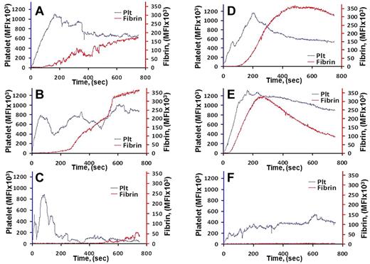 Figure 6. Effect of scFv/TM on formation of blood clots in arterioles and venules detected using real-time in situ fluorescence microscopy. Saline (A,D), sTM (3 mg/kg; B,E), or an equimolar dose of scFv/TM (C,F) was injected in the jugular vein 1 hour before injury; N = 3 per group. Lanes indicate time-dependent platelet and fibrin accumulation at sites of arteriolar (A-C) and venular (D-F) injury. P = .0318, sTM versus scFv/TM.