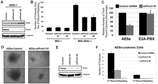 Figure 6. The role of Prmt1 in AE9a-mediated self-renewal in murine BM cells. (A) Western blot analysis for AE9a and Prmt1 expression from BM cells cotransduced with AE9a, control shRNA, or shPrmt1 retroviruses after puromycin selection. α-tubulin is used as a loading control. (B) Bar chart represents the number of colonies from the third-round replating of BM cells. Error bars represent SDs of 3 independent experiments. (C) BM cells were cotransduced with AE9a or E2A-PBX in combination with control shRNA or shPrmt1 #1. Bar chart represents the relative number of colonies from the third-round replating of BM cells. Error bars represent SDs of 2 independent experiments. (D) Typical image of the third-round colonies generated from BM cells cotransduced with AE9a, control shRNA, or shPrmt1 retroviruses. (E) Western blot analysis for Prmt1 expression from AE9a-leukemic cells transduced with control shRNA or shPrmt1 retroviruses after puromycin selection. α-tubulin is used as a loading control. Images were taken using Nikon Eclipse TS100 microscope with 10×/0.25 objective lens and Nikon DS Camera Control Unit DS-U2 system. (F) Bar chart represents the number of colonies from the second- and third-round replating of primary AE9a leukemic cells. Error bars represent SDs of 3 independent experiments.