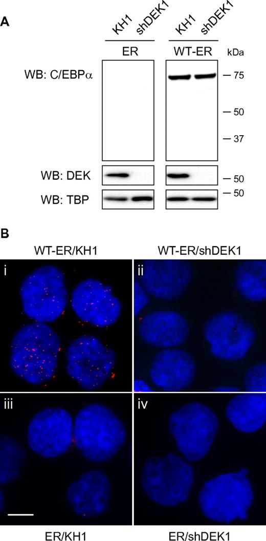 Figure 2. C/EBPα and DEK colocalize in K562 cells. K562 lines expressing control (ER alone) and C/EBPα–ER (WT-ER) were transduced with lentiviral particles encoding GFP alone (KH1) or GFP along with shRNA targeting DEK (shDEK1). After 48 hours, GFP+ populations were enriched by FACS. (A) Aliquots of sorted populations were probed by immunoblot for C/EBPα, DEK, and TATA-binding protein protein expression 24 hours after FACS enrichment. (B) Separate aliquots of sorted populations were treated with β-estradiol for 2 hours to induce C/EBPα nuclear translocation. Fixed cells were incubated with Abs against DEK and C/EBPα, followed by incubation with matched OLINK in situ PLA probes and imaged with fluorescence microscopy using blue (DAPI) and red (TxRed) filters, respectively (see supplemental Methods and supplemental Figure 3A-B for protocol, control images, and single-channel images, respectively). The scale bar represents 10 μm.