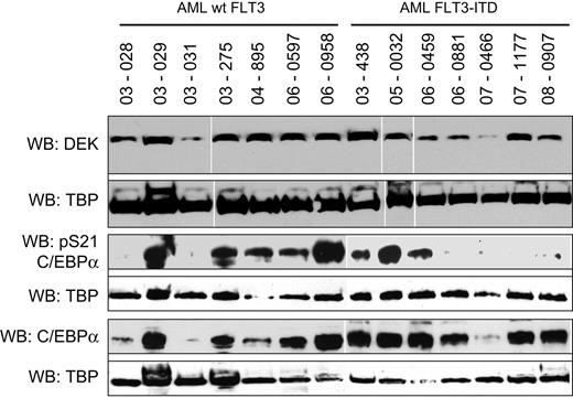 Figure 6. DEK and C/EBPα protein expression in primary AML blasts. AML blasts were isolated from cryopreserved patient samples and lysed in RIPA buffer. Expression of DEK, pS21 C/EBPα, and C/EBPα was assessed by Western blot. TATA-binding protein was used as a loading control.