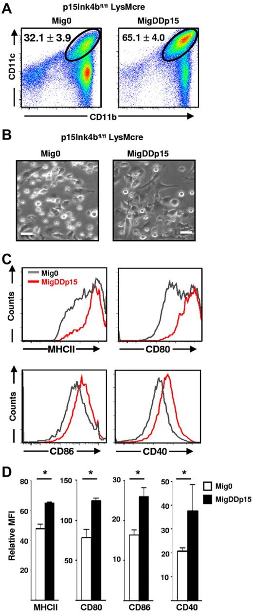 Figure 5. Reexpression of p15Ink4b results in increased differentiation and maturation of BM-DCs. (A) Lineage-negative cells from p15Ink4bfl/fl-LysMcre mice were infected with Mig0- or MigDDp15-expressing viruses, FACS sorted for GFP+ cells, and cultured in the presence of GM-CSF (20 ng/mL) and IL-4 (10 ng/mL) for 5 days to generate BM-DCs, which were then FACS analyzed for expression of CD11c and CD11b. Numbers indicate the percentage of double-positive cells ± SD from 2 independent experiments. (B) Bright-field images of the cells on day 5 of culture. Scale bars represent 10 μm. (C) BM-DCs were FACS analyzed after treatment with LPS (100 ng/mL for 16 hours) for expression of MHC II, CD80, CD86, and CD40 molecules. (D) Bar graphs depicting relative mean fluorescence intensity values of MHC II, CD80, CD86, and CD40 expression on BM-DCs derived from p15Ink4bfl/fl-LysMcre progenitors infected with Mig0 MigDDp15. Data are shown as means ± SD of 2 independent experiments. *P < .05.