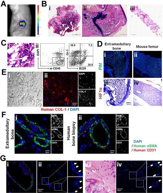 Figure 2. Establishment a human bone marrow microenvironment in NOD/SCID/IL-2rγnull mice. Human BM-derived MSCs and ECFCs mixed with Matrigel were subcutaneously injected into the flanks of mice to induce the development of extramedullary bones. (A) Eight weeks after implantation, mice were scanned in a VISEN FMT 2500 imaging system to measure osteoblastic activity using OsteoSene 750, and the fluorescence throughout the extramedullary bones was measured. (B) Representative H&E staining (shown at low magnification) shows an overview of the extramedullary bone with the typical bone structures (i). Representative imagines from mouse femur (ii) and human bone biopsy (iii) were displayed as normal bone control. Scale bar represents 1 mm. (C) Higher magnification of the H&E staining shows different kinds of hematopoietic cells with variety of morphologic appearances in the extramedullary bone cavities (i). Cells were flushed from the extramedullary bone, stained with mouse lineage antibodies, and analyzed by flow cytometry (ii). (D) Staining with the hypoxia probe pimonidazole (i-ii) and HIF1α (iii-iv) was performed to determine the presence of hypoxic conditions. Pimonidazole staining was converted to fluorescent (green) signal using the CRi multispectral system. (E) Phase-contrast (i) and confocal fluorescent (ii) images of extramedullary bone stained positive with human collagen type I (COL-1) antibody. (F) Human vasculatures were observed in the extramedullary bones (i) that displayed similar composition as the vessels in normal human bone biopsy (ii). Human CD31+ endothelial cells (red) were surrounded by αSMA+ pericytes (green). (G) CD31/αSMA/DAPI (i) and H&E (ii) staining displayed typical blood vasculature and bone structure, the adjacent slides were used for FISH (iii,iv); green spots indicate positive hybridization on human X chromosome (white arrows). The figures show 1 representative result of at least 5 experiments.