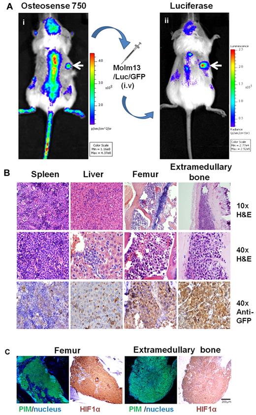 Figure 4. Leukemic cells engraft onto extramedullary bones. (A) MSC-ECFC-Matrigel mixture was injected into the flanks of mice 6 weeks before the leukemic-cell transplantation. (i) Images captured by the IVIS system (using ICR filters) show the osteoblastic activity of the extramedullary bones (white arrow). Two weeks after MOLM13/Luc/GFP cell transplantation, the mice were imaged in the IVIS system after injection of the luciferase substrate. (ii) A positive luciferase signal was observed in both mouse skeletons and extramedullary bones (white arrows indicate the extramedullary bones). (B) Histologic sections of spleen, liver, femur, and extramedullary bones were stained with H&E or an anti-GFP antibody. (C) Staining with the hypoxia probe pimonidazole and HIF1α also was performed to determine the presence of hypoxic conditions after leukemia engraftment. Pimonidazole (PIM) staining was converted to fluorescent (green) signal using the CRi multispectral system. The results shown are representative of at least 5 separate experiments.