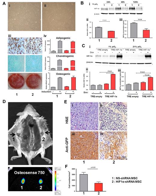 Figure 5. HIF1α-shRNA MSC–derived extramedullary bones show reduced leukemic cell engraftment. (A) After puromycin selection, the NS-shRNA MSCs (i) and HIF1α-shRNA (ii) MSCs exhibited similar morphology. Both of the MSCs differentiate along multiple mesenchymal lineages with induction of special media, including adipocytes (first row), chondrocytes (second row), and osteoblasts (last row; iii). The degrees of differentiation were determined by quantitative RT-PCR analysis for the expression of lineage markers, ABL1 was used as reference housekeeping gene (iv). No significant differences were found between NS-shRNA MSCs and HIF1α-shRNA MSCs. (B) NS-shRNA MSCs and HIF1α-shRNA MSCs were exposed to hypoxic conditions (1% oxygen) for different times. Western blot analysis showed significant down regulation of the HIF1α protein levels (i). SDF-1α transcription levels were diminished (∼ 30%; P < .01) in HIF1α-shRNA MSCs compared with control NS-shRNA MSCs (ii). Consistent with quantitative RT-PCR, HIF1α-shRNA MSCs secreted lower levels of SDF-1α than NS-shRNA MSCs (P < .05; n = 4; iii). (C) HIF1α accumulated in TRE HIF1α MSCs with the doxycycline administration in both hypoxia (1% pO2) and normoxia (21% pO2; i). This correlated with the significantly up-regulation of SDF-1α transcription and secretion (ii-iii). (D) Extramedullary bones with similar morphology and osteoblastic activity developed from NS-shRNA MSCs and HIF1α-shRNA MSCs. (E) Representative H&E (i-ii) and anti-GFP staining (iii-iv) shows different cell densities in the cavities of 2 types of extramedullary bones. (F) Slides stained with anti-GFP antibody were analyzed in a CRi system. Five images per slide were quantified and averaged at 3 different focal depths within the tissue section. The results showed a significant reduction of GFP+ leukemic cell density in HIF1α-shRNA MSC-derived extramedullary bones compared with the control MSC-derived bones (P = .0006). (1) NS-shRNA MSCs in panels A and B and extramedullary bones derived from NS-shRNA MSC-ECFC-Matrigel in panels D through F. (2) HIF1α-shRNA MSCs in panels A and B and extramedullary bones derived from HIF1α-shRNA MSC-ECFC-Matrigel in panels D through F.
