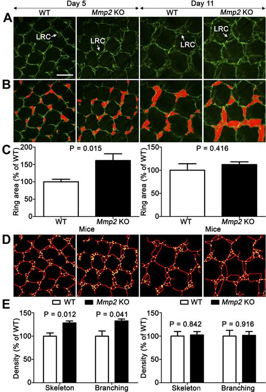 Figure 1. Mmp2 deficiency affects early tail dermal lymphangiogenesis. (A) Dermal lymphatic vasculature is visualized in Mmp2-deficient mice (Mmp2 KO) and WT mice by whole-mount LYVE-1 immunohistochemistry on postnatal days 5 and 11. LRC forming in the honeycomb network is delineated on original pictures (white arrow; A) and outlined in red through a computerized method (B). Images in panels A and B are representative of at least 40 images (n = 5). (C) Mean ring-area was determined with a computerized method as described in “Tail and ear whole-mount preparations.” The densities of vessel skeleton (delineated in red) and intersections (yellow points; D) were determined by a computer-assisted method (E). Results are expressed as percentage of control. Error bars indicate SEM. Bars represent 200 μm in each panel. Tissues stained with Alexa Fluor 488 (Molecular Probes) were used mounted in Vectashield mounting medium (Vector Laboratories) and excited using a multi-Argon laser. Panels are Z-stack average projections of Z-series pictures that were acquired at room temperature, on a TCS SP2 confocal microscope (Leica Microsystems) with a 2 μm step size using Leica Confocal 2.5 acquisition software (Leica) and a 10× NA 0.3 HC PL FLUOTAR lens (Leica).