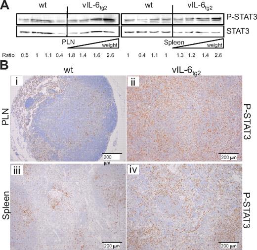 Figure 4. Increased STAT-3 phosphorylation in PLNs and spleen of vIL-6tg2 mice. (A) Western blot for STAT3 tyrosine-705 phosphorylation (P-STAT3) and total STAT3 in PLN and spleen tissue from 4 wild-type and 4 vIL-6tg2 mice (15 weeks old). Lysates from vIL-6tg2 tissues were loaded according to increasing weight for the PLN (inguinal nodes combined; wt, 5.3-7.1 mg; vIL-6tg2, 9.2-38.9 mg) and spleen (wt, 60.9-78.8 mg; vIL-6tg2, 76.8-166.2 mg). Ratio of P-STAT3 to total STAT3 band intensities is given. (B) IHC for P-STAT3 of 21-week-old wild-type (i,iii) and vIL-6tg2 (ii,iv) lymph node (i-ii) and spleen (iii-iv; 10-fold magnification).