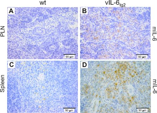 Figure 5. Increased mIL-6 expression in PLNs and spleen of vIL-6tg2 mice. IHC for mIL-6 in lymph node (PLN; A-B) and spleen (C-D) from 21-week-old wild-type (A,C; 20-fold magnification) and vIL-6tg2 (B,D; 40-fold magnification) mice. A subset of sinusoidal cells in PLN tissue expressed mIL-6 only in transgenic mice (B). A subset of cells in the red pulp of spleens from transgenic mice expressed mIL-6 (D).