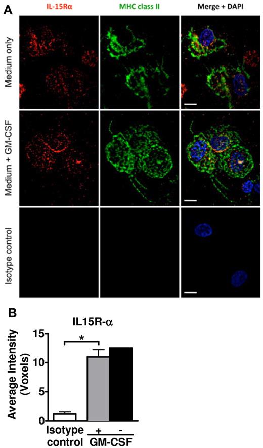 Figure 1. Human primary LCs express IL-15R-α. (A) Epidermal sheets from healthy skin were cultured in complete RPMI-10% NHS. GM-CSF 1000 IU/mL was added or not to maintain LC viability.21 The cells recovered in culture after 40 to 48 hours were cytocentrifuged, fixed and permeabilized, and stained as indicated for IL-15R-α (red), HLA-DR (green), and 4,6-diamidino-2-phenylindole (blue nuclear DNA stain). Scale bars represent 10 μm. (B) At least 20 cells in randomly selected fields from each donor/condition were evaluated to calculate the average voxels, which represent digitalized 3-dimensional image data. Shown in the bar graph are the averaged replicate means from 3 independent experiments ± SEM. *P = .0254. Error bar not shown for the condition without GM-CSF, as lower viability yielded sufficient cells from only 2 independent experiments.