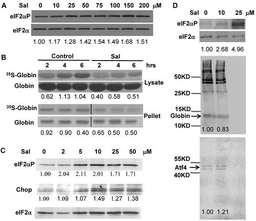Figure 6. Modulation of Hri signaling by salubrinal in β-thalassemic erythroid precursors. (A) eIF2αP levels in Hri+/−Hbb−/− reticulocytes. Cells were treated for 6 hours with concentrations of salubrinal indicated. (B) Globin protein synthesis in Hri+/−Hbb−/− reticulocytes. After treatment with 100μM salubrinal for 2 hours, globin protein synthesis at times indicated was measured in the supernatant and pellet fractions. Vertical lines have been inserted to indicate a repositioned gel lane. The middle lane between Control and Sal in the bottom rows (pellet), which was the salubrinal treated sample at time zero before 35S-Met/Cys labeling, was removed. (C) eIF2αP and Chop in Hri+/−Hbb−/− FL erythroid precursors. Cells were treated for 12 hours with salubrinal at concentrations indicated. Numbers in panels A and C denote the ratio of eIF2αP/ eIF2α or Chop/eIF2α. Numbers in panel B denote the ratio of 35S-globin/total globin. (D) eIF2αP levels and protein synthesis in Ter119+ cells from Hri+/+Hbb−/− spleen. Cells were treated for 3.5 hours with salubrinal as indicated, and labeled with 35S-Met/Cys for the last 3 hours. Total protein syntheses in the cell lysates are shown in the middle panel. Newly synthesized 35S-Atf4 immunoprecipitated with antibody (Abnova) is shown in bottom panel. Numbers indicate ratio of eIF2αP/eIF2α or globin and Atf4 syntheses relative to 0 μM controls.