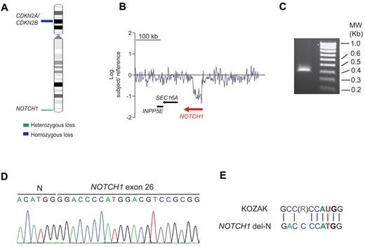 Figure 1. Isolation and analysis of a NOTCH1 intragenic deletion in human T-ALL. (A) Chromosome 9 ideogram showing deletions identified by aCGH encompassing the CDKN2A/B tumor suppressor gene and the NOTCH1 locus in T-ALL. (B) aCGH plot showing an intragenic focal deletion of NOTCH1 in chromosome band 9q34. (C) Agarose gel electrophoresis of a truncated NOTCH1 cDNA sequence isolated by 5′-RACE using a primer located in exon 28 of NOTCH1. (D) Nucleotide sequence of the NOTCH1 5′ RACE product. (E) Kozak consensus sequence alignment of the NOTCH1 sequences surrounding methionine 1668 located at the N-terminal portion of the NOTCH1 del-N amino acid sequence. R indicates purine (adenosine or guanosine).