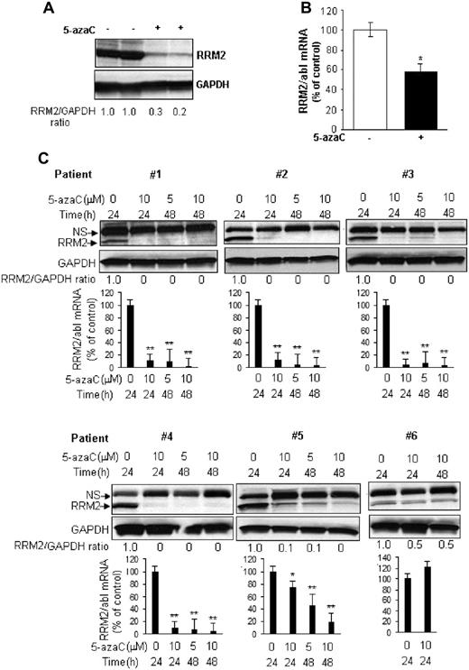 Figure 2. 5-azaC down-regulates RRM2 expression ex vivo and in vivo. (A-B) 5-azaC inhibits RRM2 protein (A) and mRNA (B) expression in MV4-11 tumor xenografts in mice. Athymic nu/nu mice subcutaneously inoculated with MV4-11 cells were treated with 5-azaC and the engrafted tumor tissues were subjected to analysis. (C) 5-azaC reduces the RRM2 level in primary BM cells from AML patients. Primary cells from 6 patients were cultured in vitro and treated with the indicated concentrations of 5-azaC for 24 or 48 hours. Cells were then collected for Western blot and quantitative RT-PCR analyses. For Western blot analysis, densitometry was performed to quantify each lane, and the ratio of RRM2 over the loading control GAPDH is presented under each blot. For quantitative RT-PCR analysis, the data are presented as a percentage of the untreated controls. The results are means ± SD of the representative experiment performed in triplicate. *P < .05 and **P < .01 versus untreated controls.