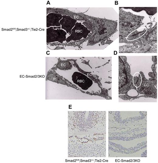 Figure 3. Collapsing vascular structure in the midbrain. Electron microscopic analysis of brain capillaries from Smad2fl/fl;Smad3+/−;Tie2-Cre (A-B) and EC-Smad2/3KO (C-D) embryos at E11.5. Panels A and C, 2000× magnification; panel B and D, 50 000× magnification. Samples were observed using an electron microscope (H7000; Hitachi) operated with 75 kV at 20°C. Each area surrounded by the circle reveals tight junction between ECs. (E) Transverse sections of midbrains from E10.5 embryos were stained with anti–claudin-5 antibody as well as with hematoxylin. EC indicates endothelial cell; P, pericyte; and RBC, red blood cell.