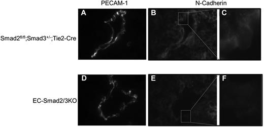 Figure 6. Immunohistochemical analysis of N-cadherin expression in DA of E10.5 embryos. Transverse frozen sections of Smad2fl/fl;Smad3+/−;Tie2-Cre (A-C) and EC-Smad2/3KO embryos (D-F) were stained with anti–PECAM-1 (A-D) and anti–N-cadherin antibodies (B-C,E-F). In panels C and F, the square areas in panels B and E are shown at higher magnifications, respectively.