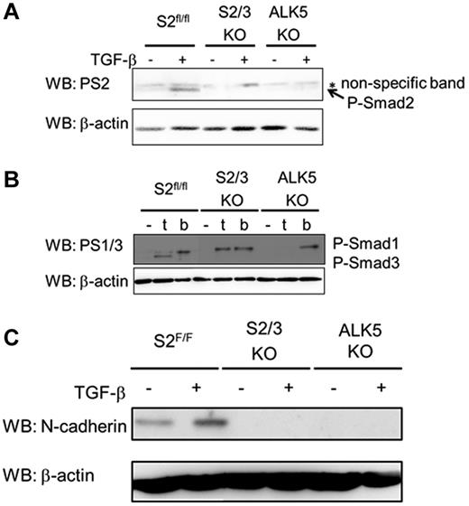 Figure 7. TGF-β/Smad2/3 signaling induces N-cadherin expression. (A) TGF-β–induced Smad2 phosphorylation in ECs. MEECs were stimulated with TGF-β for 1 hour. The filters were incubated with anti-phosphorylated Smad2 (PS2; top panel) and anti–β-actin antibodies (bottom panel). P-Smad2, phosphorylated Smad2. (B) Detection of phosphorylated Smad1 and phosphorylated Smad3 on TGF-β (t) or BMP (b) stimulation. MEECs were stimulated with TGF-β or BMP6 for 1 hour. The filters were incubated with anti-phosphorylated Smad1/3 (PS1/3; top panel), which specifically recognize phosphorylated Smad1 and Smad3, and anti–β-actin antibodies (bottom panel). P-Smad1 indicates phosphorylated Smad1; and P-Smad3, phosphorylated Smad3. (C) TGF-β–induced N-cadherin expression in MEECs. MEECs were stimulated with TGF-β for 48 hour. The filters were incubated with anti–N-cadherin (top panel) and anti–β-actin antibodies (bottom panel).