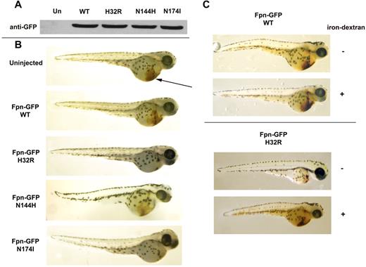Figure 1. Expression of mutant Fpn in zebrafish affects hemoglobinization of erythrocytes. Zebrafish embryos were injected with wild-type or mutant Fpn-GFP. At 48 hpf, the embryos were homogenized (A), and Fpn-GFP levels were assayed by Western blot analysis or (B) stained with o-dianisidine to detect hemoglobinized cells (brown color denoted by the arrow). The figures are representative of 6 different experiments in which 100 embryos were injected with each construct. The survival rate (n = 600) was 69.6% for embryos injected with wild-type constructs, 50.8% for embryos injected with H32R constructs, 64.7% for embryos injected with N144H constructs, and 48.2% for embryos injected with N174I constructs. (C) Embryos were injected with wild-type or H32R constructs with or without coinjection of iron-dextran. The survival rate was 70% for wild-type embryos injected with or without iron-dextran, 50% for wild-type embryos injected with H32R without iron-dextran, and 62% for wild-type embryos injected with iron-dextran.