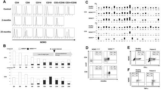Figure 1. Identification and characterization of NEMO revertant T cells in patient 2. (A) Intracellular expression of NEMO in various PBMC lineages from a healthy adult control and patient 2 were evaluated by flow cytometry. For the patient, results of the analyses performed at 2 months and 23 months are shown. Solid lines indicate staining with the anti-NEMO mAb, and dotted lines indicate the isotype control. (B) Time-course variations in the absolute count of NEMOnormal and NEMOlow T cells in patient 2. M indicates age in months. (C) TCR-Vβ repertoire analysis of the patient's CD4+ and CD8+ T cells. PBMCs from the patient and a healthy adult control were stained for the TCR-Vβ panel, CD4, CD8, and NEMO, and analyzed by flow cytometry. (D) Phenotype analysis of T cells in patient 2. PBMCs from the patient and a control were stained for the expression of NEMO, CCR7, CD45RA, and CD4 or CD8. Data shown were gated on NEMOnormal or NEMOlow CD4+ or CD8+ cells. (E-F) Cytokine production from NEMOnormal and NEMOlow T cells. PBMCs from the patient and a control were stimulated with PMA and ionomycin for 6 hours and stained for intracellular (E) IFN-γ or (F) TNF-α along with NEMO. Cells shown are gated on the CD3+ population.