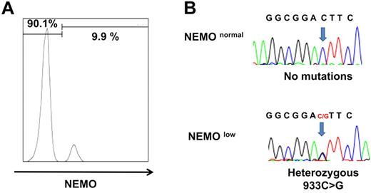 Figure 3. NEMO revertant T cells in patient 3. (A) Intracellular expression of NEMO in CD8+ cells from patient 3. (B) Sequencing chromatograms of DNA from NEMOnormal or NEMOlow CD8+ cells of patient 3. Arrows indicate the mutated base position at c. 931.
