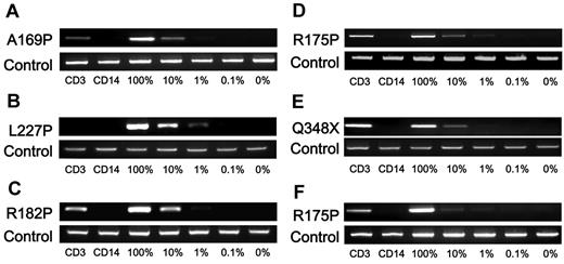 Figure 4. NEMO reversion selectively occurs in T cells of XL-EDA-ID patients. Allele-specific PCR for NEMO on CD3+ or CD14+ cells from (A) patient 4, (B) patient 5, (C) patient 6, (D) patient 7, (E) patient 8, and (F) patient 9. Numbers below each figure indicate the percentages of wild-type NEMO cDNA mixed with each mutant. Primers used in each PCR are shown on the left.