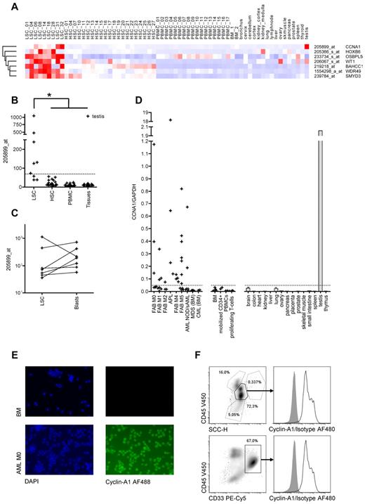 Figure 2. Identification of cyclin-A1 as target candidate by in silico expression analysis and RT-PCR quantification. (A) Seven candidate target genes predicted in silico: Heatmap of normalized probe sets. Each row represents one probe set, and each column represents one sample dataset. Red represents increased levels of expression; and blue, decreased levels of expression. The darkest shade of red/blue represents average expression ± 3 SDs. (B-C) Model-based expression of probe set 205899_at representing cyclin-A1. (B) Expression in AML LSCs compared with HSCs/CD34+ BM mononuclear cells, PBMCs, and nonhematopoietic somatic tissues. The dashed line represents the cut-off value of 69.2 (mean plus 3 SDs of the HSC samples). *P < .001 (explorative). (C) Expression in AML LSCs and corresponding blasts (P = .297). (D) Cyclin-A1 expression quantified by quantitative RT-PCR. The dashed line represents the cut-off value of 0.048 (mean plus 3 SDs of the BM samples). (E) Immunofluorescence staining of cyclin-A1 in primary AML samples (representative example). Shown is a healthy BM (top row) and primary leukemic blasts (bottom row). Cells were stained with 4,6-diamidino-2-phenylindole (DAPI; left) and indirectly for cyclin-A1 (AlexaFluor-488, right). Negative controls without primary antibody and nonspecific isotype showed no fluorescence in both samples (not shown). Images were captured using a Nikon Eclipse E800 microscope. (F) Intracellular FACS staining of cyclin-A1 in primary AML blasts (representative example). BM mononuclear cells of a patient with cyclin-A1-expressing AML after gating out doublets in forward scatter (FSC)-area/height (A/H) and SSC-A/H plots. Top row: gating on blasts based on SSC and CD45 expression. Bottom row: gating on CD33-positive cells. Histograms show cyclin-A1 (black line) and isotype control (shaded) in the blast population.