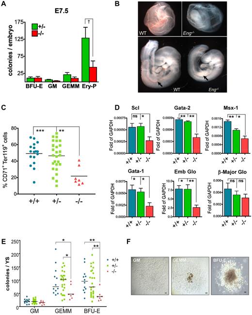 Figure 4. Defective hematopoiesis in Eng−/− embryos. (A) Whole E7.5 embryos derived from Eng+/− intercross were plated in M3434 and cultured in a low-oxygen incubator. The number of EryPs was reduced drastically in Eng−/− embryos (43.00 ± 18.2; n = 3) compared with Eng+/− (128.3 ± 31.52; n = 3) embryos (P = .0395 by 1-tailed Student t test). Definitive hematopoietic colonies do not show significant differences at this early time point. (B) YS from WT E9.5 embryos show normal vasculature, full of erythrocytes, whereas YS from Eng−/− embryos present primitive vasculature containing very few RBCs. Severe anemia was also observed in the AGM region of Eng−/− embryos (arrows in bottom panels). (C) The frequency of CD71+Ter119+ cells (erythroblasts) is severely decreased in Eng−/− YS compared with Eng+/− or Eng+/+ YS. **P < .05 and ***P < .01 by ANOVA. (D) qPCR gene-expression analyses in E9.5 YS from WT (+/+; n = 9), heterozygotes (+/−; n = 18), and knockout embryos (−/−; n = 15). Transcripts are normalized to GAPDH. Bars represent average gene expression for each genotype. Error bars indicate the SEM for each genotype. *P < .05 and **P < .01 by ANOVA. (E) E9.5 YS cells from Eng+/− intercrosses were assayed for hematopoietic colony formation. The frequency of GEMM and BFU-E progenitors was decreased significantly in the YS of knockout embryos (−/−; n = 7) compared with heterozygous (+/−; n = 25) or WT (+/+; n = 12). Horizontal bar represents the mean. *P < .05 and **P < .01 by ANOVA. (F) Representative GM, GEMM, and BFU-E colonies are shown at similar magnification (10× objective).