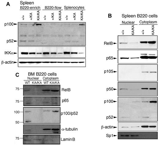 Figure 5. Reduced activity of canonical and noncanonical NF-κB components in the splenic and BM B cells of KA/KA mice. (A) Western blot showing the indicated protein levels in splenic cells. B220-enrich indicates column-purified B220+ cells; B220-flow, non-B cells that passed through the column; splenocytes, total cell lysate from whole spleen; β-actin, protein-loading control. (B-C) p65 (RelA), RelB, p100/52, and p105/p50 expression levels in nuclear and cytoplasmic fractions of spleen and BM B220+ cells of WT (+/+) and KA/KA mice. Lamin B and sp1 were used as controls for the purity of nuclear extracts.