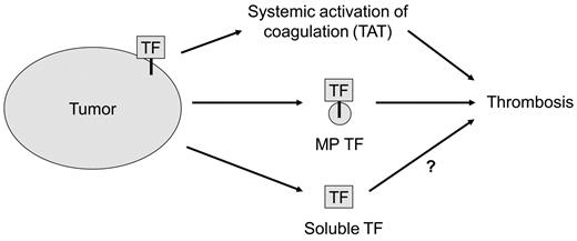 Figure 7. Sources of tumor TF that activate coagulation and enhance thrombosis. We propose that tumor TF may cause the activation of coagulation that leads to increased levels of circulating TAT in the circulation, whereas TF-positive MPs may enhance venous thrombosis at a distal site. Tumors also release degraded TF protein (soluble TF) into the plasma.