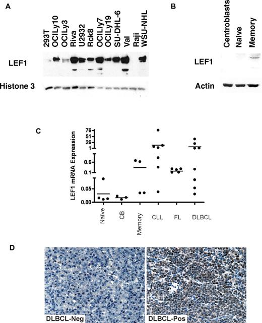 Figure 7. LEF1 expression in B cells and B-cell derived lymphomas. (A) LEF1 protein expression in nuclear extracts of DLBCL cell lines was assayed by immunoblotting with LEF1 antibody using 293T and Raji cells as controls. Immunoblotting for Histone 3 served as a loading control. (B) LEF1 protein expression in cell extracts of normal B cells at different differentiation stages analyzed by immunoblotting with LEF1 antibody. (C) LEF1 mRNA expression in normal B cells at different differentiation stages and in primary CLL, FL, and DLBCL cell suspensions. (D) Immunohistochemistry of primary DLBCL specimens using LEF1 antibody. Representative examples of LEF1 negative (left) and positive (right) specimens are shown. Images were acquired using a Nikon Eclipse E1000 microscope (Nikon) equipped with 40× objective lenses. Images were captured with a SPOT flex mosaic 15.2 digital camera and software (Diagnostic Instruments). Digitized images were processed using Adobe Illustrator Version 10 software (Adobe Systems).