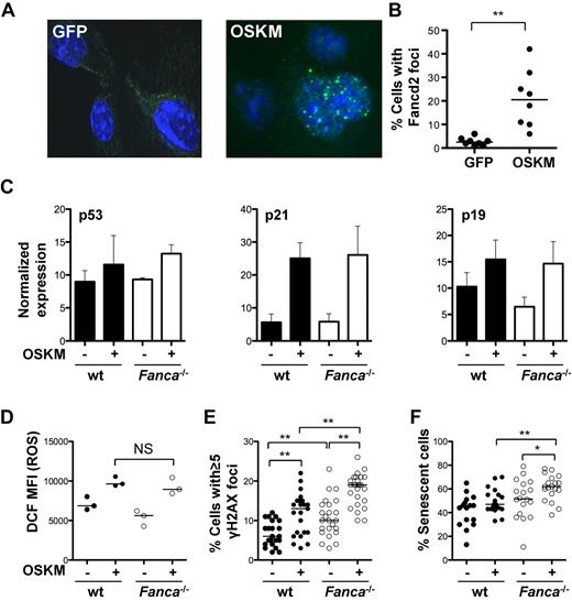 Figure 2. Reprogramming activates the FA pathway and induces DNA damage. (A) Representative photomicrograph of FANCD2 immunofluorescence in control transduced or reprogrammed WT TTFs (60× magnification). (B) Percentage of cells containing FANCD2 foci as assessed by immunofluorescence 7 days after reprogramming. (C) Normalized expression of p53, p21, and p19 as determined by immunoblot in WT and Fanca−/− TTFs at baseline and 4 days after reprogramming (n = 4). Data are ± SEM. (D) Level of ROS measured by 2′,7′-di-chlorofluorescein (DCF) FACS analysis at baseline and 2 days after reprogramming. (E-F) Percentage of cells with ≥ 5 γH2AX foci (E) and percentage of cells undergoing senescence at baseline and 4 days after reprogramming (F). Filled circles, WT; open circles, Fanca−/−. OSKM indicates Oct3/4, Sox2, Klf4, c-Myc. *P < .05; **P < .01; NS, not significant by Wilcoxon rank-sum test. Horizontal line in panels B, D, E, and F represents the median.