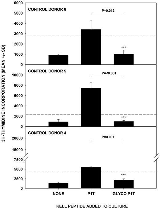 Figure 6. Glycosylation of k peptide determines the ability to stimulate T-cell proliferation. The k peptide 1T(179-193) was synthesized in glycosylated (GLYCO P1T) and unglycosylated (P1T) forms and used to stimulate T cells from unimmunized donors 4-6. P < .05 was taken as significant inhibition (t test on log-transformed data).