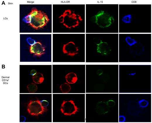 Figure 4. IL-15 concentrates in the DC–T-cell immunologic synapse. Skin LCs (top panel) or dermal CD1a+ DCs (bottom panel) were cocultured with purified allogeneic naive CD8+ T cells for 12 hours. CD40L was used to activate the DCs. Confocal immunofluorescence images show IL-15 accumulation (green) at the immunologic synapse that is generated between skin LCs (top panel) or dermal CD1a+ DCs (bottom panel) and naive CD8+ T cells. HLA-DR and CD8 are represented in red and blue, respectively. Data are representative of 3 independent experiments.