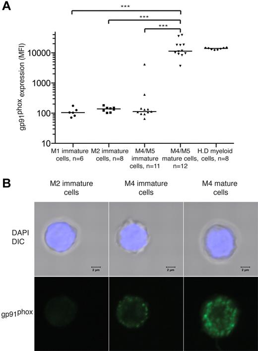 Figure 2. gp91phox is expressed by mature malignant FAB-M4 and FAB-M5 AML cells. BM or peripheral blood cells from patients with FAB-M1, FAB-M2, or FAB-M4/M5 AML were stained for gp91phox. Results show intensity of gp91phox expression (MFI) of cells with CD33+ and/or CD34+ phenotype with medians indicated. Immature cells were defined by absence of CD14 and CD15. Mature FAB-M4/M5 cells were defined as cells expressing CD14. H.D represents gp91phox expression by peripheral blood monocytes from healthy donors. (B) Confocal photomicrographs of FACS-sorted immature M2 cells (left), immature M4 cells (center), and mature M4 cells (right) showing gp91phox expression. The sorted FAB-M2 (patient 2) cells were NPM1+ and FLT3/ITD+. Immature and mature cells from the patient with FAB-M4 AML (patient 6) carried t(16;16). The nucleus was made visible by DAPI staining (blue) and gp91 was visualized using a FITC-conjugated primary antibody. Bars represent 2 μm.