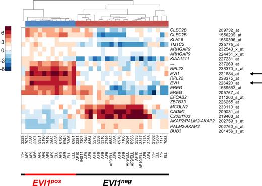 Figure 1. Supervised gene expression profiling of MLL-rearranged AMLs uncovers 2 different subgroups. Pearson correlation clustering of 35 MLL-rearranged leukemias defined 2 subgroups, an EVI1pos group and an EVI1neg group (supplemental Figure 1). Supervised analysis revealed 22 probe sets that were differentially expressed between the 2 MLL-rearranged subgroups. Red color corresponds to high correlation, whereas blue color corresponds to low correlation of mRNA expression of genes in patient samples. Note that arrows (←) point to probe sets for EVI1 mRNA expression, which are part of the distinctive signature separating the 2 clusters.