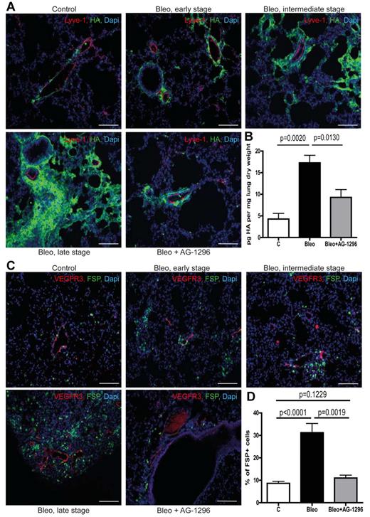 Figure 3. Aberrant mural cell recruitment results in perilymphatic accumulation of hyaluronan with subsequent formation of fibrotic lesions. (A) Simultaneous immunodetection of HA and lymphatic vessels (Lyve-1) in fibrotic lungs of mice treated with bleomycin (Bleo), bleomycin + AG-1296 (Bleo + AG-1296) or in healthy control lungs of PBS-treated mice, respectively at day 28 on tissue of early, intermediate, and late stage fibrosis. Scale bars equal 100 μm. (B) Quantitative analysis of HA in lungs at day 28 after treatment with bleomycin, bleomycin + AG-1296 or PBS, respectively (controls n = 3, Bleo n = 6, Bleo + AG-1296 n = 6). (C) Immunodetection of fibroblasts (FSP) and lymphatic vessels (VEGFR3) in lungs of Bleo-, Bleo + AG-1296–, and PBS-treated mice, respectively, on tissue showing early, intermediate and late stage fibrosis at day 28. Scale bars equal 100 μm. (D) Quantitative analysis of FSP-positive cells at day 28 in Bleo, Bleo + AG-1296, and PBS-treated mice, respectively (controls n = 15, Bleo n = 29, Bleo + AG-1296 n = 13). Error bars show SEM.