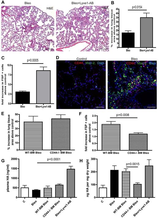 Figure 4. Various HA surface receptors contribute to HA clearance in the lung with different outcomes on pulmonary fibrosis. (A) H&E histology on lung tissue of mice treated with bleomycin (Bleo; 10 mg/kg body weight twice a week intraperitoneally) or with bleomycin + Lyve1 antibody (Bleo + Lyve1-AB; (10 mg/kg body weight twice a week intraperitoneally; 100 μg Lyve1-AB 5 times every other day intraperitoneally, starting at day 15 after the first bleomycin injection) at day 28 (Bleo n = 5, Bleo + Lyve1-AB n = 5, control n = 2). Scale bars equal 200 μm. (B) Quantitative analysis of the percentage increase in the area of lung tissue of bleomycin and bleomycin + Lyve1 antibody-treated mice above PBS-treated control (100 μL twice a week intraperitoneally) mice. (C) Quantitative analysis of FSP-positive cells on lung tissue Bleo and Bleo + Lyve1-AB–treated mice in comparison to control mice. (D) Immunodetection of CD44-positive cells (CD44) and Mac-2–positive macrophages (Mac-2) in lungs of PBS- (control) and bleomycin-treated (Bleo) mice at day 28. Scale bars equal 100 μm. (E) Quantitative analysis of the percentage increase in the area of lung tissue of mice that first received either wild-type (WT-BM Bleo) or CD44-deficient (CD44−/− BM Bleo) BM (recipients were irradiated with 10 gray, after 24 hours 5 × 106 BM cells of WT or CD44-deficient donor mice were injected intravenously into the tail vein) and were then treated with bleomycin (10 mg/kg body weight twice a week intraperitoneally, starting day 21 after transplantation) above PBS-treated control mice (control; recipients were irradiated with 10 gray, after 24 hours 5 × 106 BM cells of CD44-deficient donor mice were injected intravenously into the tail vein); 100 μL PBS twice a week intraperitoneally, starting day 21 after transplantation) mice (WT-BM Bleo n = 5, CD44−/− BM Bleo n = 7, CD44−/− BM PBS n = 4). (F) Quantitative analysis of FSP-positive cells on lung tissue of WT-BM Bleo and CD44−/− BM Bleo mice in comparison with control mice. (G) Quantitative analysis of hyaluronan-levels (HA) in plasma at day 28 of PBS, Bleo, WT-BM Bleo, CD44−/− BM Bleo and Bleo + Lyve1-AB–treated mice. (H) Quantitative analysis of hyaluronan-levels (HA) in lungs at day 28 of PBS, Bleo, WT-BM Bleo, CD44−/− BM Bleo and Bleo + Lyve1-AB–treated mice. Error bars show SEM.