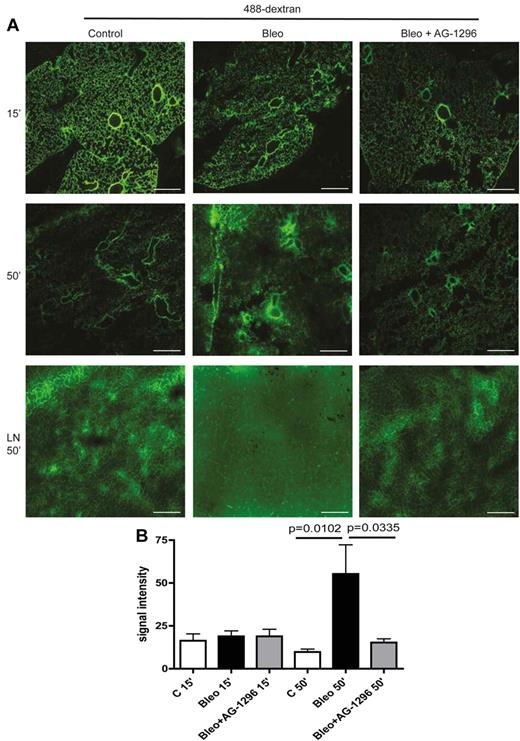 Figure 5. Aberrant mural cell recruitment to lymphatics leads to impaired lymphatic drainage of the lung and can be restored by inhibition of PDGFR-β–signaling. (A) Fluorescence microscopy of 488-dextran (50 μL injected intratracheally at day 28) 15 and 50 minutes after injection in lung tissue of mice treated with bleomycin (Bleo), bleomycin+AG-1296 (Bleo + AG-1296) or in healthy control lungs of PBS-treated mice, respectively. Pretracheal lymph nodes (LN) were analyzed 50 minutes after 488-dextran injection. Scale bars equal 100 μm. (B) Quantitative analysis of the fluorescence signal intensity of 488-dextran measured with ImageJ in lung tissue of Bleo-, Bleo + AG-1296–, or PBS-treated mice, 15 and 50 minutes after injection, respectively (n = 3 for each group). Error bars show SEM.