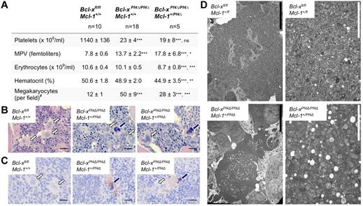 Figure 4. Megakaryocyte-specific loss of Bcl-x and 1 allele of Mcl-1 predisposes megakaryocytes to cell death. (A) Peripheral blood counts from 7-week-old mice. Data represent mean ± SD, 1-way ANOVA with Bonferroni multiple comparison test. MPV indicates mean platelet volume. Bcl-xPf4Δ/Pf4Δ Mcl-1+/Pf4Δ mice were firstly compared with Bcl-xfl/fl Mcl-1+/+ controls, and secondly to Bcl-x–deficient Bcl-xPf4Δ/Pf4Δ Mcl-1+/+ mice. #Morphologically recognizable megakaryocytes were enumerated in H&E-stained sternum sections from: n = 3, Bcl-xfl/fl Mcl-1+/+; n = 8, Bcl-xPf4Δ/Pf4Δ Mcl-1+/+; n = 4, Bcl-xPf4Δ/Pf4Δ Mcl-1+/Pf4Δ mice. Data represent mean number per field of view (×200) from 10 fields per individual mouse. (B) H&E-stained BM sections. Megakaryocytes with abnormal morphology are indicated by dark blue arrows. Normal megakaryocytes are indicated by white arrows. Scale bars: 20 μm. (C) Caspase-3–positive atypical megakaryocytes present in Bcl-xPf4Δ/Pf4Δ Mcl-1+/Pf4Δ spleen. Cleaved capase-3 in brown and hematoxylin in blue. Blue arrows point to apoptotic megakaryocytes positive for active caspase-3. Note the dark pyknotic nuclei. White arrows indicate healthy megakaryocytes, negative for caspase-3. Scale bars: 20 μm. (D) Representative transmission electron microscope images of BM sections demonstrating the presence of apoptotic megakaryocytes in Bcl-xPf4Δ/Pf4Δ Mcl-1+/Pf4Δ mice. Right panels show high-magnification ultrastructure of the corresponding megakaryocytes shown in the left panels. Scale bars: 2 (white) or 10 (black) μm.