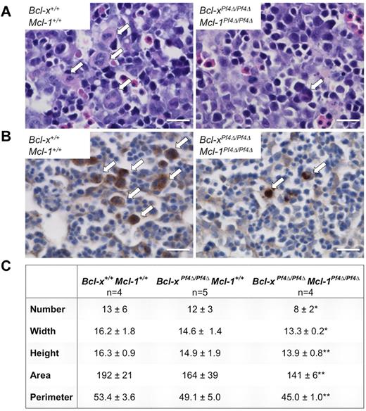 Figure 6. Bcl-xPf4Δ/Pf4Δ Mcl-1Pf4Δ/Pf4Δ fetal liver megakaryocytes are reduced in number and size. (A) Representative images of H&E-stained E12.5 fetal liver sections. White arrows indicate megakaryocytes. Scale bar: 20 μm. Images were acquired on a Nikon Eclipse E600 microscope equipped with AxioCam MRc5 (Zeiss) and AxioVision 4.8. Scale bars were inserted with ImageJ 1.42q. (B) Representative images of E12.5 fetal liver sections stained with anti-VWF (brown). White arrows indicate megakaryocytes. Images were acquired as in panel A. Scale bar: 20 μm. (C) Megakaryocytes were enumerated and width (μm), height (μm), area (μm2), and perimeter (μm) determined from 5-7 separate images of H&E-stained E12.5 fetal liver sections/embryo using Metamorph image processing software (Version 7.0). n = 4, Bcl-x+/+Mcl-1+/+; n = 5, Bcl-xPf4Δ/Pf4Δ Mcl-1+/+; and n = 4, Bcl-xPf4Δ/Pf4Δ Mcl-1Pf4Δ/Pf4Δ embryos. Data represent mean ± SD.