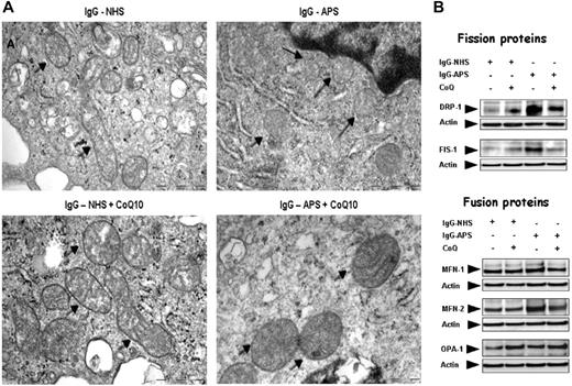 Figure 6. Changes in mitochondrial ultrastructure and dynamics in IgG-APS–treated cells and effects of CoQ10 pretreatment. Monocytes were treated with IgG-APS or IgG-NHS in the presence or in the absence of CoQ10 and then fixed with aldehydes, postfixed with osmium tetroxide, dehydrated, and embedded in epoxy resin. Thin sections were cut and stained with uranyl acetate and lead citrate for observation with an electron microscope. Alternatively, after cell treatments extracts were obtained as described under “Western blotting and EMSAs,” the proteins were separated by SDS-PAGE, transferred to nitrocellulose sheets, and stained with antibodies against proteins controlling mitochondrial fission (Drp1 and Fis1) and fusion (Mfn1, Mfn2, and Opa1). (A) Representative pictures of mitochondria from cells treated as indicated. Bar represents 1 μm. (B) Western blot detection of proteins controlling mitochondrial dynamics. Approximately 20 μg protein was loaded in each lane. This figure depicts a representative result from 3 independent determinations.