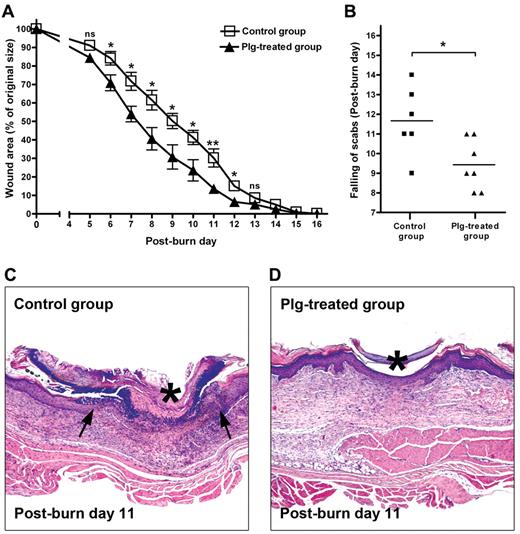 Figure 1. Effect of plg treatment on burn wound healing in WT mice. (A) Quantification of the remaining wound area at different time points after wounding in the BSA-treated control group (n = 6) and the plg-treated group (n = 7). (B) Comparison of the healing times (scab falling off) in the days after wounding. *P < .05; **P < .01. (C-D) Representative pictures of the control group and the plg-treated group on day 11 after injury. The leading edges of the epithelium layer are indicated by arrows and the scab is indicated by an asterisk. Magnification is 50×.