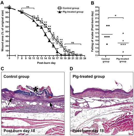 Figure 5. Effect of plg treatment on wound healing in db/db mice. (A) Quantification of the remaining wound area at different time points after wounding in the BSA-treated control group (n = 6) and in the plg-treated group (n = 6). (B) Comparison of the healing times (scab falling off) in the days after wounding. (C-D) Representative pictures of the control group and the plg-treated group on day 18 after injury. The inflamed tissue is indicated by arrows and the scab is indicated by an asterisk. Magnification is 50×.