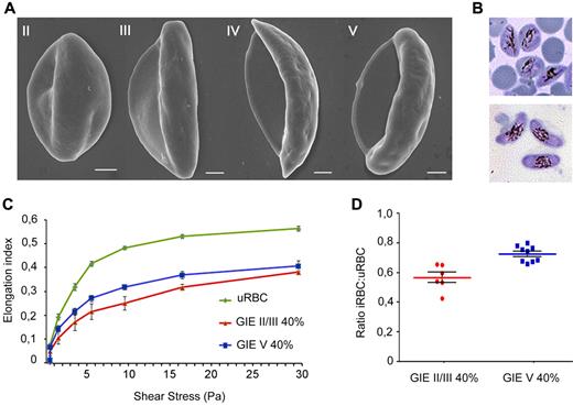 Figure 1. Scanning electron microscopy and ektacytometry analysis of immature and mature P falciparum GIEs. (A) Scanning electron microscopy images of Plasmodium falciparum GIEs (B10 clone) from stage II to stage V of maturation. Bars represent 1 μm. (B) Giemsa staining images of stage II/III (top panel) and stage V (bottom panel) GIE samples used in ektacytometry analysis. (C) Response to increasing shear stress of erythrocytes infected by P falciparum stage II/III (red line) and stage V (blue line) gametocytes (40% parasitemia) and of uninfected erythrocytes (green line). Error bars represent SE. (D) Ratios of EIs of infected versus uninfected erythrocytes calculated from the 3- to 9.49-Pa range of shear stresses in the ektacytometry analysis (C) showing a statistically significant difference between immature and mature GIEs (Mann-Whitney rank-sum test, P = .0004).