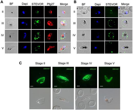 Figure 3. Immunofluorescence analysis of STEVOR protein expression in GIEs. (A) Analysis of STEVOR protein expression in fixed stages II to V GIE preparations. GIEs were acetone-fixed and costained with mouse anti-S2 (green) and rabbit anti-Pfg27 (red) followed by anti–mouse Alexa-488– and anti–rabbit Alexa-594–conjugated IgG. Parasite nuclei were stained with DAPI (blue). Bright-field (BF) and merge images are shown. Bars represent 2 μm. (B) Analysis of live GIEs immunostained with rabbit anti-S2 (green) specifically recognizing native STEVOR on the surface of stages III and IV GIEs. Bound antibody was detected with anti–rabbit Alexa-488–conjugated IgG. BF, nuclear staining (DAPI, blue), and merge images are shown. (C) Immunofluorescence analysis of STEVOR expression in fixed stages II to V-GIEs. GIEs were methanol-fixed and stained with a pool of mouse polyclonal antibodies directed against STEVOR proteins followed by anti–mouse Alexa-488–conjugated IgG (green). Bars represent 2 μm.
