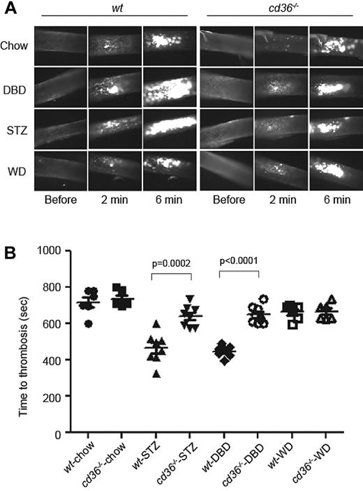 Figure 4. DM accelerates arterial thrombus formation in mice in vivo in a CD36-dependent manner. (A) Age-matched wt or cd36-null mice were maintained on chow, DBD, or WD for 8 weeks and then subjected to FeCl3-induced carotid artery injury to induce thrombus formation. STZ indicates chow-fed mice treated with STZ to induce pancreatic islet destruction and type 1 DM. Platelets were labeled in vivo by injection of rhodamine 6G and thrombi were imaged by fluorescence videomicroscopy. Representative images obtained at various time points are shown. (B) Time to occlusive thrombus formation was assessed using 6-8 mice per group.