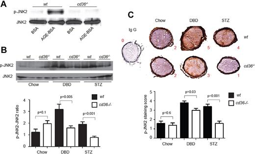 Figure 6. JNK2 phosphorylation levels are increased in platelets and thrombi in diabetic mice. (A) Washed platelets from wt or cd36-null mice were treated with AGE-BSA or BSA control (50 μg/mL) for 15 minutes. Lysates were then assessed by immunoblot using anti–phospho-JNK2 Ab. An Ab to total JNK2 was used as a loading control. Blot is representative of 4. (B) Platelets from chow-, DBD-, and STZ-fed wt or cd36-null mice were analyzed by immunoblot as in panel A. A representative immunoblot of 4 is shown. The bar graph shows the ratio of phospho-JNK2 (p-JNK2) to total JNK2. (C) Representative images of thrombosed carotid arteries from chow-, DBD-, and STZ-fed wt or cd36-null mice stained with anti–p-JNK. Bar graph shows staining intensity scores for p-JNK (n = 5 mice per group).