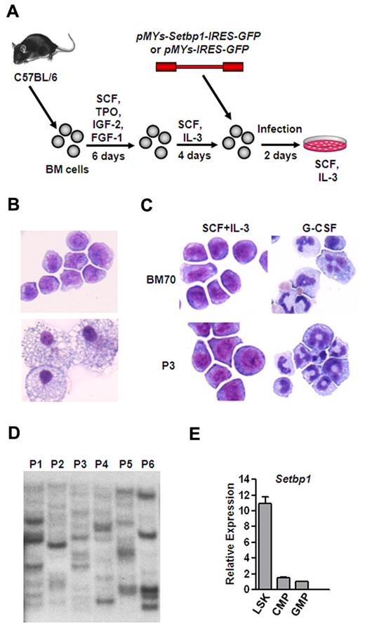 Figure 1. Efficient immortalization of myeloid progenitors by Setbp1 expression. (A) Schematic diagram of the immortalization procedure. (B) Representative cytospin preparation and Wright-Giemsa staining of cells infected with Setbp1 (top panel) or empty retrovirus (bottom panel) at 1 month after infection. Original magnification ×400. Images were obtained using a Nikon Eclipse E800 microscope and a Qimaging Micropublisher 5.0 digital camera. (C) Cytospin preparation of Setbp1-immortalized cells (BM70 and P3 population) before and after treatment with G-CSF for 2 days. BM70 cells are immortalized by insertional activation of endogenous Setbp1.12,13 Original magnification ×400. (D) Southern blotting analysis of viral integrations present in 6 Setbp1-immortalized myeloid progenitor populations (P1-P6) using a GFP-specific probe. Seven ug of genomic DNA from each population was digested with EcoRI, resulting the generation of a single GFP-containing DNA fragment from each provirus. Each band represents an independent integration. (E) Real-time RT-PCR analysis of total RNA isolated from purified LSK, CMP, and GMP populations of C57BL/6 mice using Setbp1-specific primers. Relative expression levels were calculated by normalizing to β-actin mRNA levels in the same sample and also in LSK cells. The mean and SD of each relative expression level is shown.