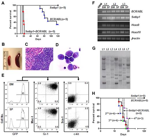 Figure 6. Setbp1 cooperates with BCR/ABL to transform committed myeloid progenitors. (A) Survival curves of lethally irradiated C57BL/6-Ly5.2 mice receiving 1 × 106 in vitro expanded BM progenitors infected with MSCV-BCR/ABL-IRES-GFP virus, pMYs-Setbp1-IRES-GFP virus, or the combination. Results are combined from 3 independent experiments with each containing the 3 indicated groups. Transduction efficiencies: 28%-42% for BCR/ABL groups; 19%-25% for Setbp1 groups; and 21%-31% for cotransduction groups. Secondary recipients receiving 1 × 106 spleen cells from primary leukemic mice died of leukemia between 11 and 13 days as indicated by the gray bar (n = 5). (B) A typical enlarged leukemic spleen (right) compared with a control normal spleen (left). (C) H&E staining of a typical liver section from leukemic mice displaying liver infiltration by the leukemic cells. Original magnification ×100. (D) Wright-Giemsa staining of cytospin preparation from the BM of a leukemic mouse. Original magnification ×400. (E) Staining of GFP positive leukemic cells from the BM and spleen (SP) of a typical moribund mouse with indicated antibodies. Numbers represent the percentages of gated events. (F) Semiquantitative reverse transcription PCR analysis of total RNA extracted from normal mouse bone marrow (NBM), leukemic BM, and spleen (SP) from 3 leukemic mice (L1, 2, and 3) using indicated gene-specific primers. β-actin was included to control for RNA loading. (G) Southern blotting analysis of genomic DNA from leukemic spleens (L1 to L7) using a GFP-specific probe. Samples were digested by EcoRI, and each band represents a separate integration. (H) Survival curves of lethally irradiated C57BL/6-Ly5.2 primary recipient mice receiving purified mouse GMPs (1-1.5 × 105 cells/recipient) infected with MSCV-BCR/ABL-IRES-GFP virus, pMYs-Setbp1-IRES-GFP virus, or the combination as well as secondary (2nd), tertiary (3rd), and quaternary (4th) recipients of the cotransduction group receiving 1 × 106 spleen cells from preceding leukemic mice. Transduction efficiencies: 50%-60% for BCR/ABL groups; 40%-45% for Setbp1 groups; and 34%-50% for cotransduction groups.
