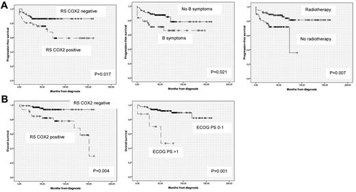 Figure 2. Prognostic factors independently associated with outcome in early-stage HL patients. (A) Prognostic factors associated with PFS. (B) Prognostic factors associated with OS.