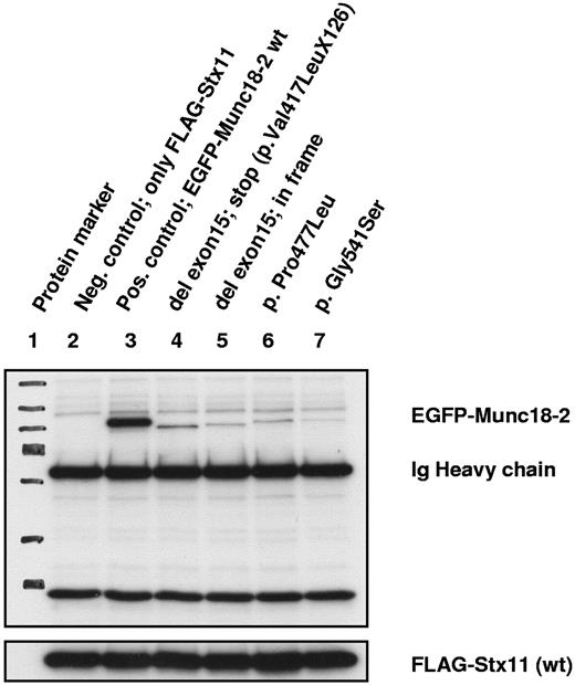 Figure 2. Coimmunoprecipitation analysis for binding between Munc18-2 and syntaxin 11 proteins. All immunoprecipitation reactions were performed with exogenous constructs with the use of either an Ab specific for Flag (syntaxin 11) or for enhanced green fluorescent protein (EGFP; Munc18-2). No endogenous proteins were analyzed. Exposition time of the x-ray film was 15 seconds. Lanes 1 through 3 show control samples, lane 4 shows the Munc18-2 construct as identified as the main RNA product detected in 2 of our patient samples with a homozygous exon 15 splice-site mutation. Lane 5 shows an artificial construct that contains an in-frame deleted exon 15. Lanes 6 and 7 are constructs representing missense mutations with nearly absent syntaxin binding. All Munc18-2 constructs, representing the different kind of mutations, show comparable loss of binding for syntaxin.