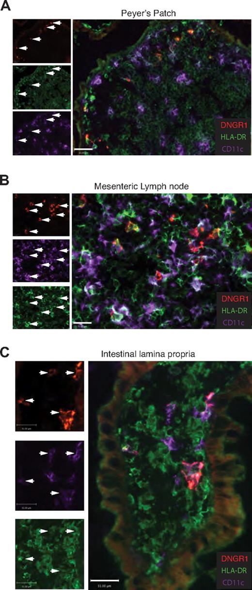 Figure 4. DNGR-1+ DCs are found in human small intestinal lamina propria, MLN, and Peyer patches. Three-color immunofluorescence staining for DNGR1, CD11c, and HLA-DR in cryosections of human intestinal tissue. The arrowheads indicate DNGR-1+ CD11c+ HLA-DR+ cells in (A) Peyer patches (n = 3), (B) MLNs (n = 3), and (C) intestinal lamina propria (n = 6). (A) Scale bar represents 63 μm. (B-C) Scale bars represent 31 μm